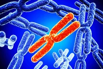 Hội chứng siêu nữ ảnh hưởng thế nào đến khả năng sinh sản?