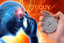 Những rủi ro xảy ra đột quỵ ở người trẻ và cách phòng ngừa