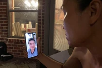 Đàm Vĩnh Hưng tiết lộ ảnh cận mặt bị bỏng nặng của Hồng Ngọc 