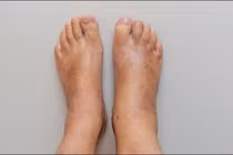 Chân có dấu hiệu này coi chừng phổi của bạn đang gặp vấn đề