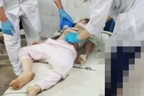 Bé gái 5 tuổi suy hô hấp nguy kịch vì hóc quả nhãn