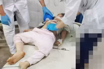 Bé gái 5 tuổi suy hô hấp nguy kịch vì hóc quả nhãn