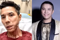 Kasim Hoàng Vũ phải cắt bỏ toàn bộ xương hàm, vẫn chưa phẫu thuật