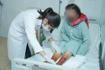 Ngâm chân với bột lá, người phụ nữ bị hoại tử 2 bàn chân 