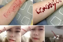 Bị bố mẹ cấm yêu thiếu nữ rạch tay khắc chữ "con xin lỗi"