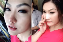 Phi Thanh Vân bị đánh chảy máu mũi