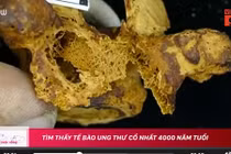 Video: Tìm thấy tế bào ung thư cổ nhất 4000 năm tuổi