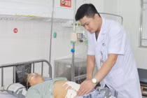 Người phụ nữ 66 tuổi thủng ruột non do vòng tránh thai lạc chỗ 