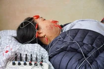 Nhiều người liệt mặt biến chứng do thời tiết lạnh, cách phòng tránh