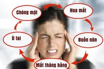 Bác sĩ chỉ cách điều trị rối loạn tiền đình