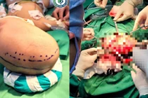 View - Hành trình hồi sinh trẻ 12 tuổi vỡ ổ dị dạng tủy cổ, hôn mê | Báo Tri thức và Cuộc sống - TIN TỨC PHỔ BIẾN KIẾN THỨC 24H