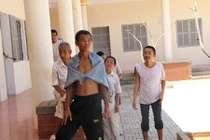 Sự thực ảnh bệnh nhân tâm thần ở truồng, ăn bốc gây bão