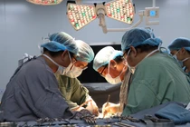 Cắt khối u buồng trứng nặng hơn 16 kg cho bệnh nhân 27 tuổi