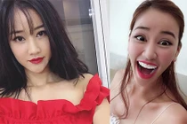 Maya cười ngất trước thông tin mặt biến dạng vì làm răng