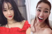 Maya cười ngất trước thông tin mặt biến dạng vì làm răng