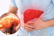 5 thói quen tàn phá gan vào mùa lạnh