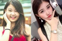 ĐD Bảo Nhân nghi Lê Âu Ngân Anh làm mũi, chỉnh hệ xương hàm