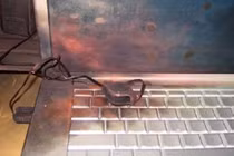 Bé trai 8 tuổi bị bỏng nặng do laptop phát nổ 