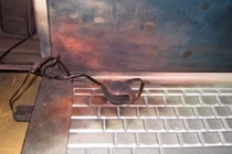 Bé trai 8 tuổi bị bỏng nặng do laptop phát nổ 