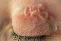 Cảnh báo nguy cơ nhiễm ký sinh trùng từ “thú cưng” 