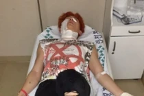 Nam ca sĩ bị bỏng khắp cơ thể khi đang quay MV