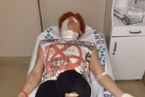 Nam ca sĩ bị bỏng khắp cơ thể khi đang quay MV