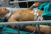 Xe khách rơi xuống vực: Chuyển lái xe về BV Việt Đức