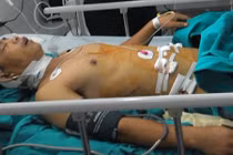 Xe khách rơi xuống vực: Chuyển lái xe về BV Việt Đức