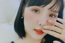 Bất ngờ nhan sắc khác lạ của Kỳ Hân sau dao kéo