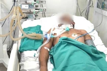 Ngã vào gốc cây mục, người đàn ông nguy kịch... vì uốn ván