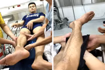 Siêu mẫu Vĩnh Thụy lên tiếng sau chấn thương nghiêm trọng