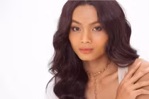 Người mẫu Kim Sang nguy kịch