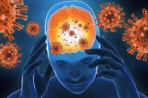 Tưởng đột quỵ, không ngờ viêm não tự miễn thể hiếm gặp