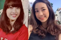 Mẹ hoa hậu Mỹ Linh giải đáp nghi vấn con gái sửa răng