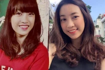 Mẹ hoa hậu Mỹ Linh giải đáp nghi vấn con gái sửa răng