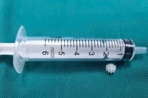 Nhiều trẻ hóc dị vật nhập viện, chuyên gia chỉ cách xử lý đúng 