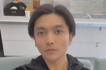 Tim xuất hiện với khuôn mặt lạ lẫm sau ồn ào bị nghi dao kéo