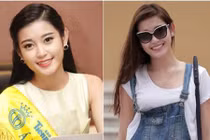 Á hậu Huyền My kém duyên khi chỉnh răng khểnh