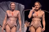 Ca sĩ nổi tiếng bị ngã đập đầu, rách mặt vẫn cố diễn