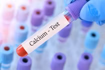 Biến chứng nguy hiểm khi hạ canxi máu và cách phòng tránh 