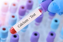 Biến chứng nguy hiểm khi hạ canxi máu và cách phòng tránh 