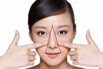 Lý do không nên nặn mụn ở vùng “tam giác tử thần”