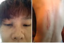 Dương Yến Ngọc bất ngờ tố chồng cũ đánh đập, hăm dọa