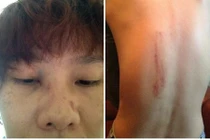 Dương Yến Ngọc bất ngờ tố chồng cũ đánh đập, hăm dọa