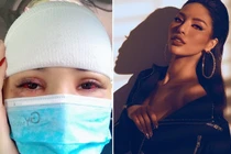 Người mẫu Khả Trang bị tai nạn, tụ máu đầu giờ ra sao?