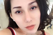 Ca sĩ Ivy Trần bị nổ túi ngực trên máy bay giờ ra sao?