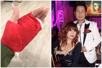 Vợ cũ Bằng Kiều bị thương đi cấp cứu, phải khâu 14 mũi
