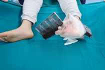 Bé trai 12 tuổi bị kẹp chân vào thang cuốn trong siêu thị