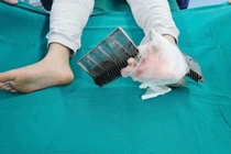 Bé trai 12 tuổi bị kẹp chân vào thang cuốn trong siêu thị