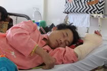 Chặt dừa, chặt gần lìa bàn tay